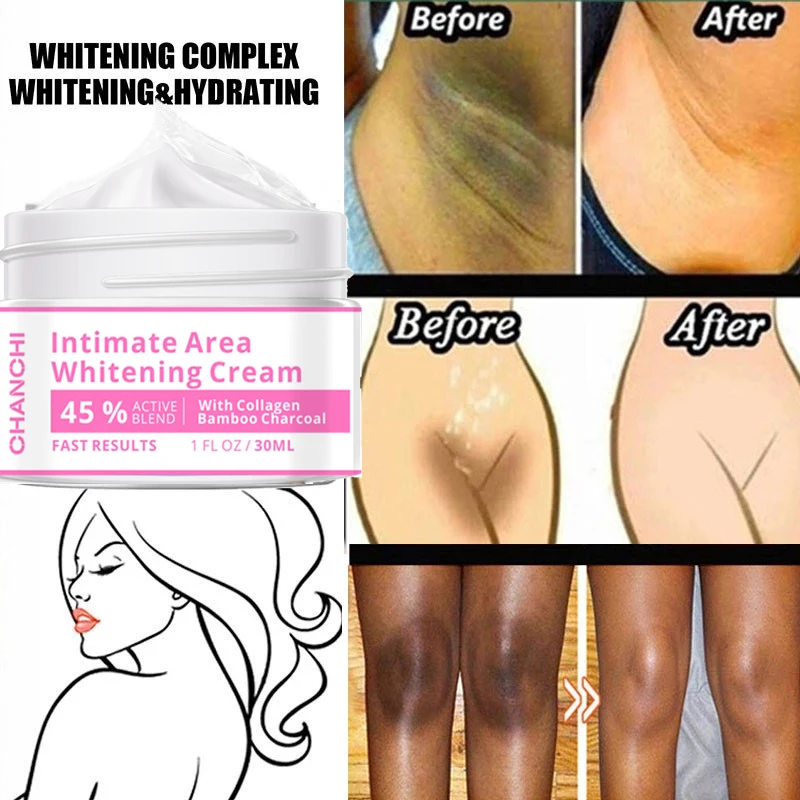 

Body Whitening Cream Private Parts Underarm Bleaching Serum Whiten Butt Knee Brighten Inner Thigh Intimate Dark Remove Melanin