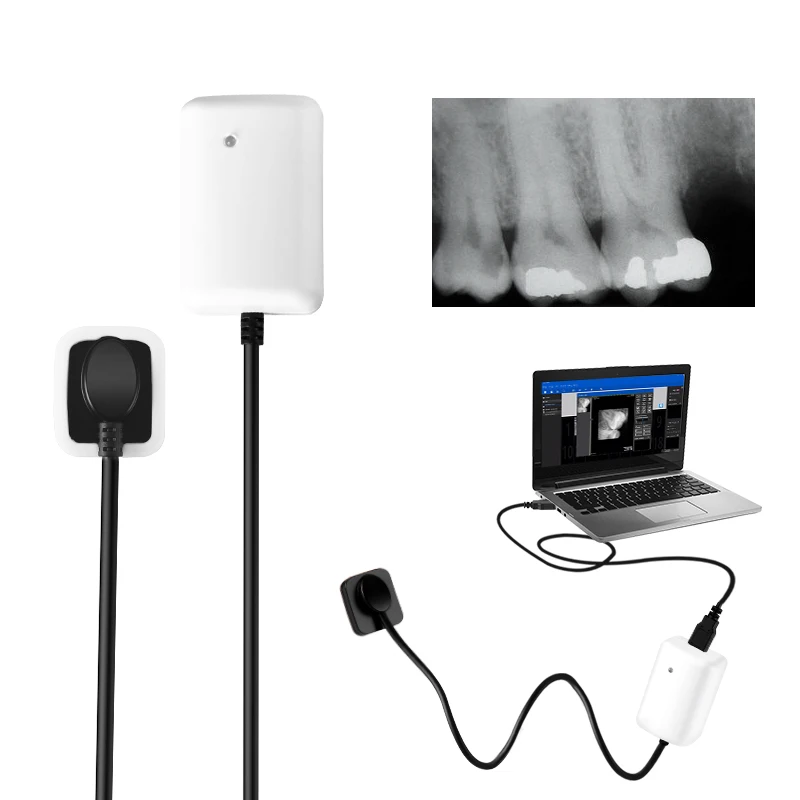 

Рентгеновский Датчик Denta-l/цифровая рентгенографическая система Denta-l