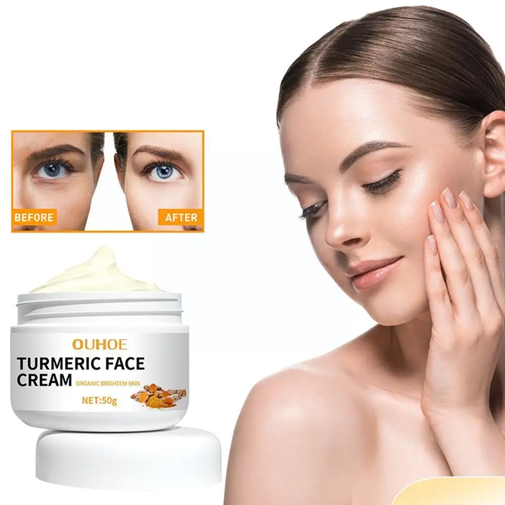 

Меркума для лица, отбеливающий крем для темных мерцаний, осветление темных пятен, фотокрем для кожи лица Car K7h2