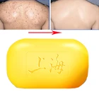 Шанхай серное мыло экзема Лечение Акне Псориаз себорейное мыло Отбеливающее средство Антибактериальный дерматит уход за кожей тела