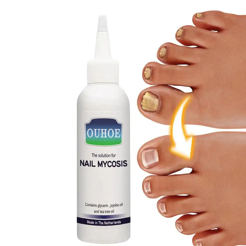 

Укрепляющее Масло для кутикулы для ногтей 75 мл масло для ногтей для тонких поврежденных ногтей мягкий пилинг масло для ногтей тонкие поврежденные ногти