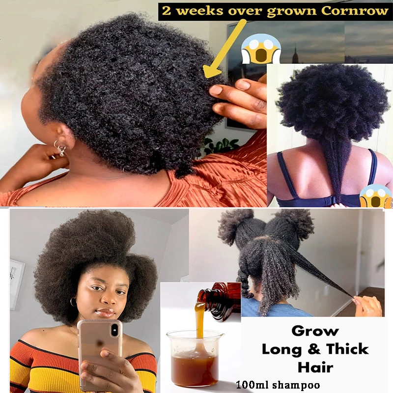 Hair Strength Regrowth Promote Rapid Hair Growth Thinning Dry Damaged Hair Thicken Herb Shampoo Handwork Shampoo Anti-Hair Loss