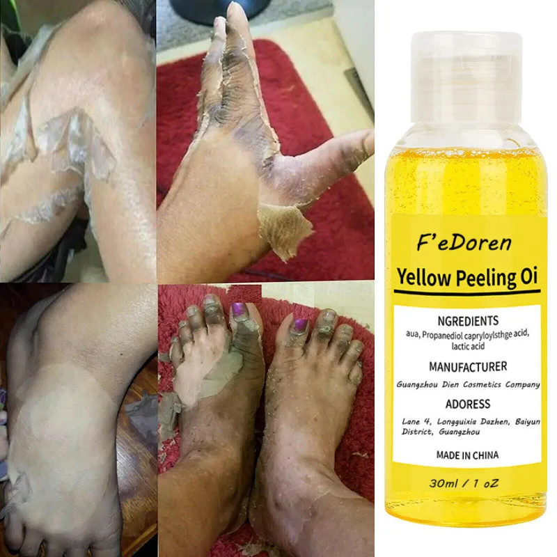 

Immediate Whitening Peel Peeling Thai Yellow Oil Remove Dullness Anti-Aging Speckle Blackhead Powder Body Brighten Clean Skin