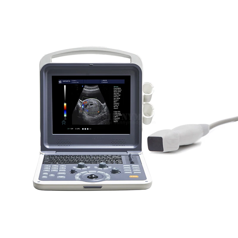 

SY-A042N Professional portable color doppler 3d 4d portable usg ultrasound machine