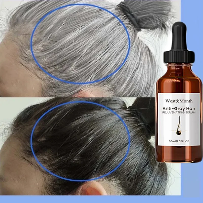 

Сыворотка для лечения серых и белых волос, питательная сыворотка для кожи головы, восстанавливает белый и черный естественный цвет, восстанавливает поврежденные серые волосы, предотвращает выпадение волос