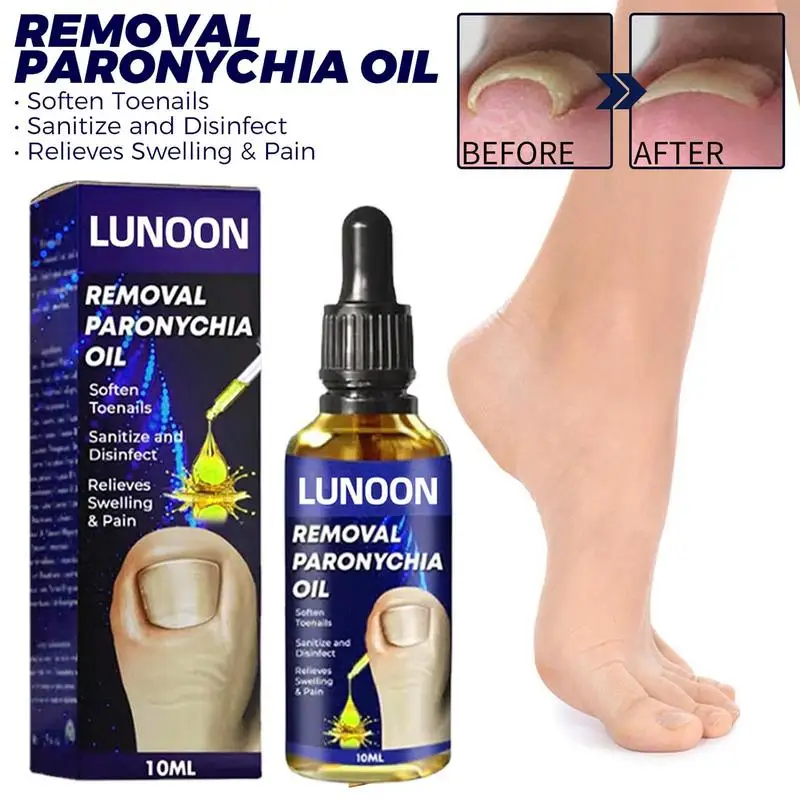 

10 мл Новый вросший канавка для ногтей рельефное масло ремонт вросших ногтей онихомикоз канавка для ногтей мягкое масло для ухода за ногтями