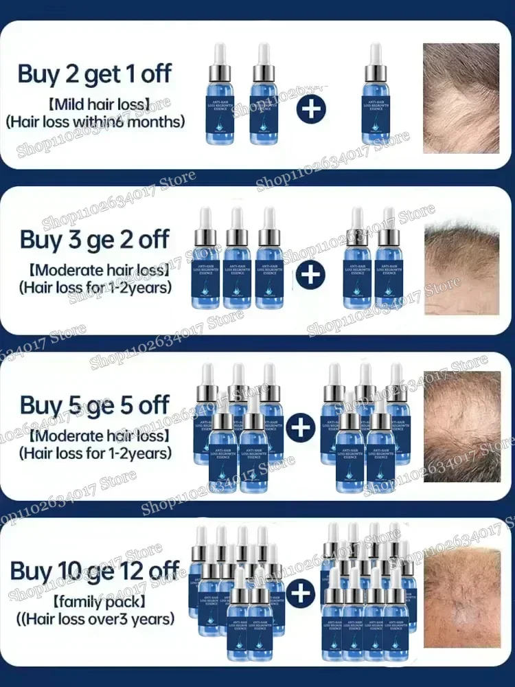 Питание и уход за мужским женским усилием Восстанавливающее лечение с ростом от