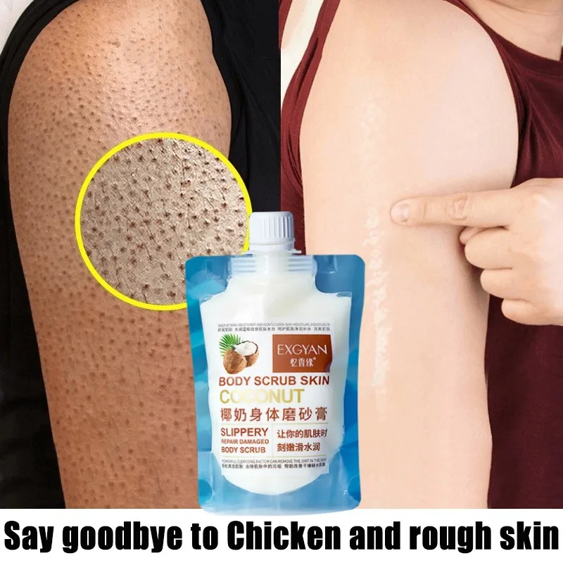 

Body Exfoliating Scrub Deep Cleansing Whitening Removing Dead Skin Bleaching Softening Exfoliating Body Scrub 300ml