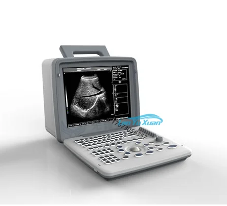 

Hot Sale Cheap Price XF300 Full Digital LED Professional Therapy Portable Ultrasound Device