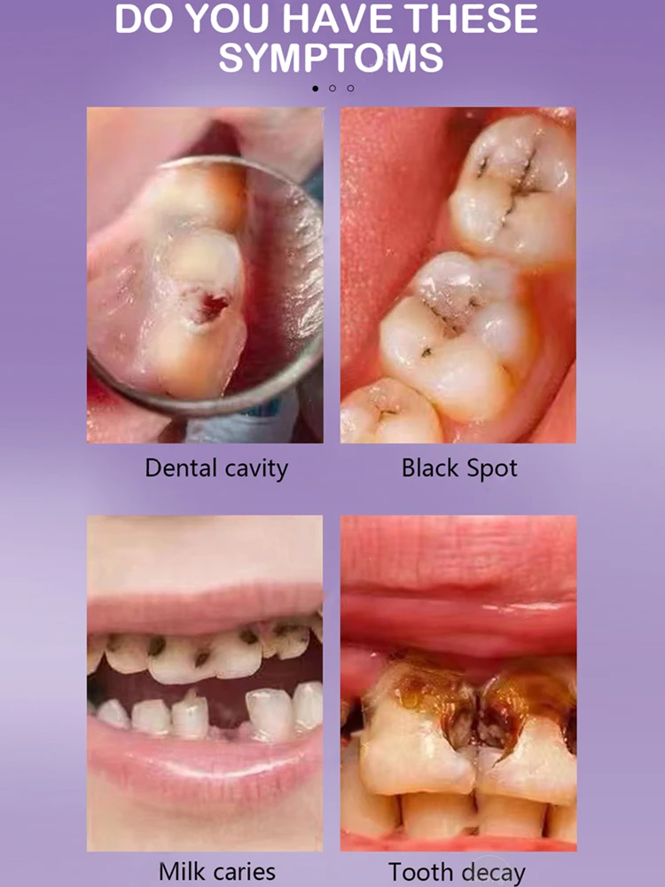 

Tooth Decay Repair Repair All Tooth Decay Cavities And Protect Teeth And Teeth Whitening New Toothpaste