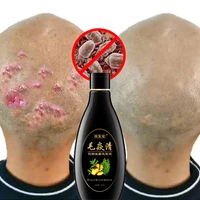 scalp hair follicle shampoo antibacterial anti itching mites oil control psoriasis and scalp cleansing shampoo skincare product