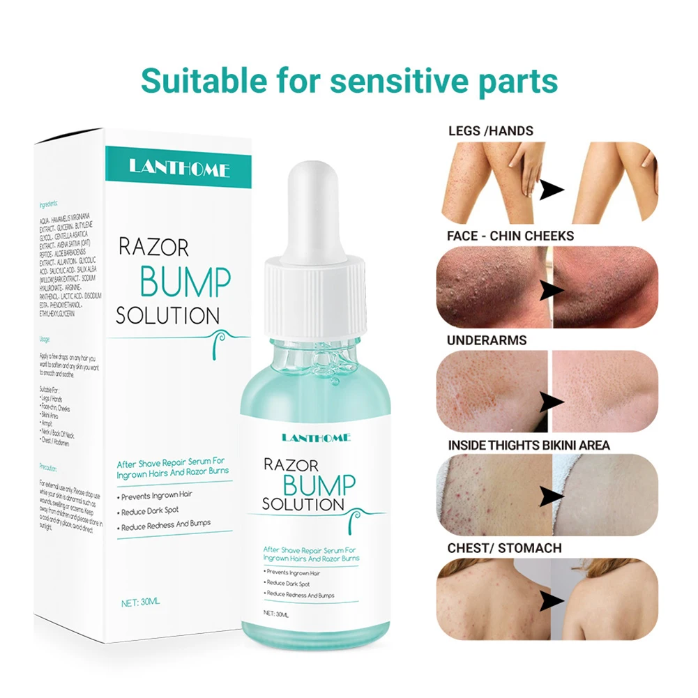 

30ml Razor Bumps Solution Shave Repair Serum Moisturizes For Ingrown Hair Inhibitor Hair Remover And Growth Inhibitor for Men