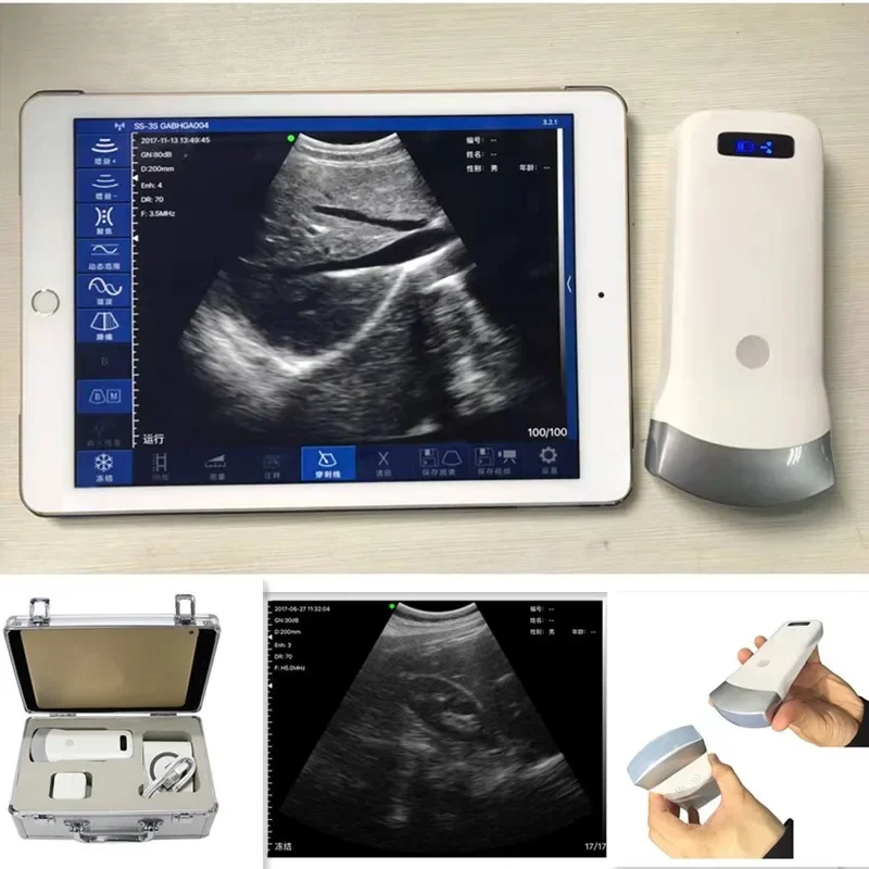 Беспроводной ультразвуковой сканер 80E выпуклый зонд 3 2 МГц с поддержкой IOS Android