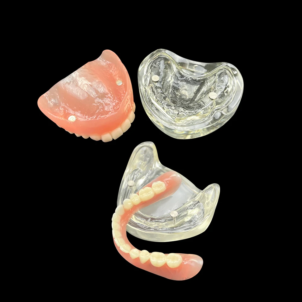 1 комплект съемный адсорбционный зуб для зубного имплантата верхняя нижняя часть