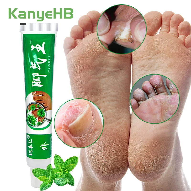1 шт. Лечебный крем для ног Tinea Pedis лечебная мазь лечения берибериса против зуда