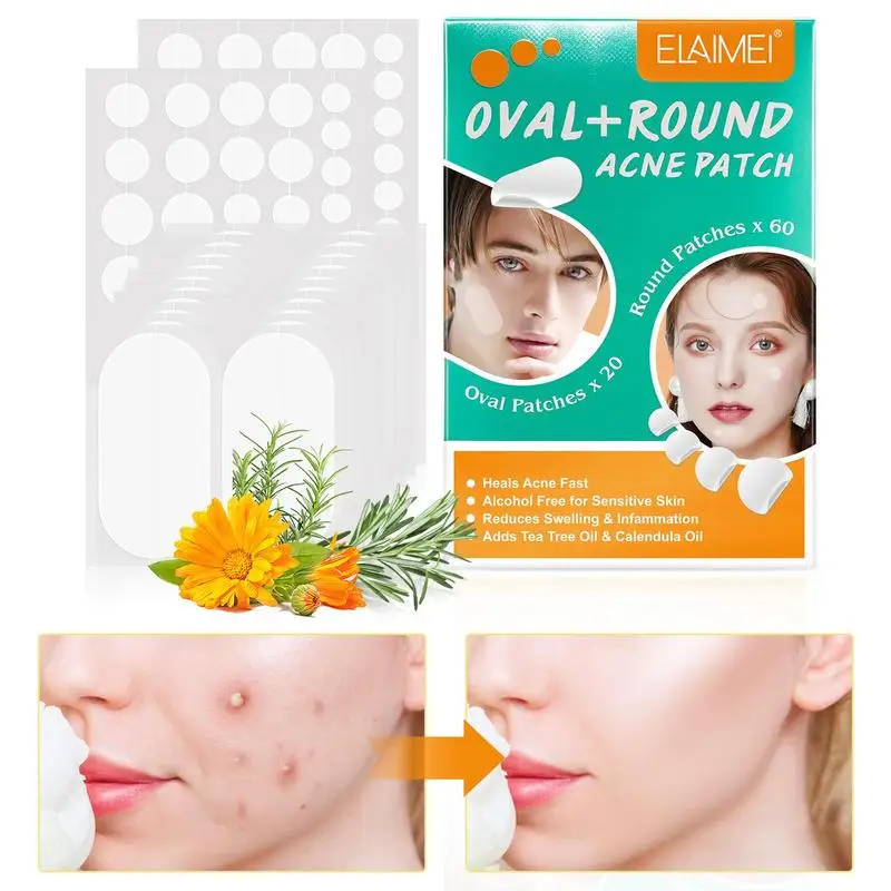 80 Patches Oval/round Acne Pimple Patch Stickers Waterproof Acne Treatments Pimple Remover Tool Facial Mask Skin Care