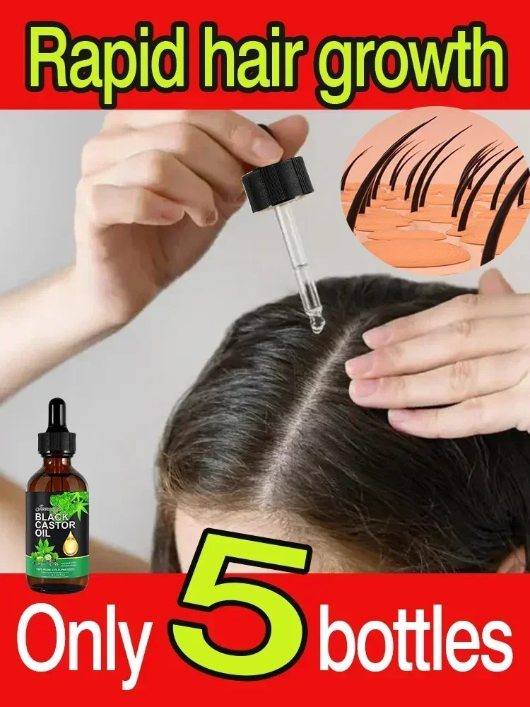 Органическое черное касторовое масло для роста волос ямайская кожа головы