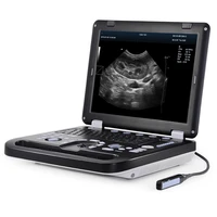 china supplier portable veterinary ultrasound diagnostic machine for animal use