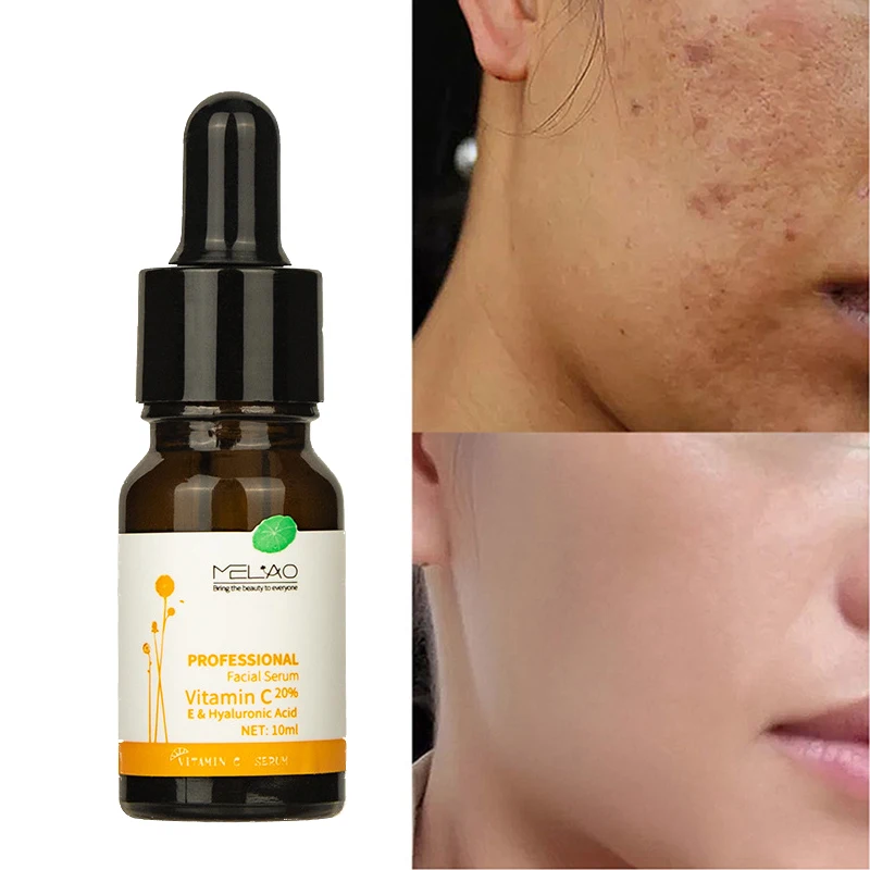 

Vitamin C Whitening Freckle Serum Retinol Anti Aging Remove Dark Spots Brighten White Repair Moisturizing Cosmetic Skin Care 30g