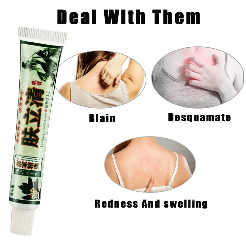 

Atopic DermatiTis Cream Psoriasis Ointment Chinese Herb Anti Fungal Infection Cream Dermatitis Eczematoid Eczema Ointment