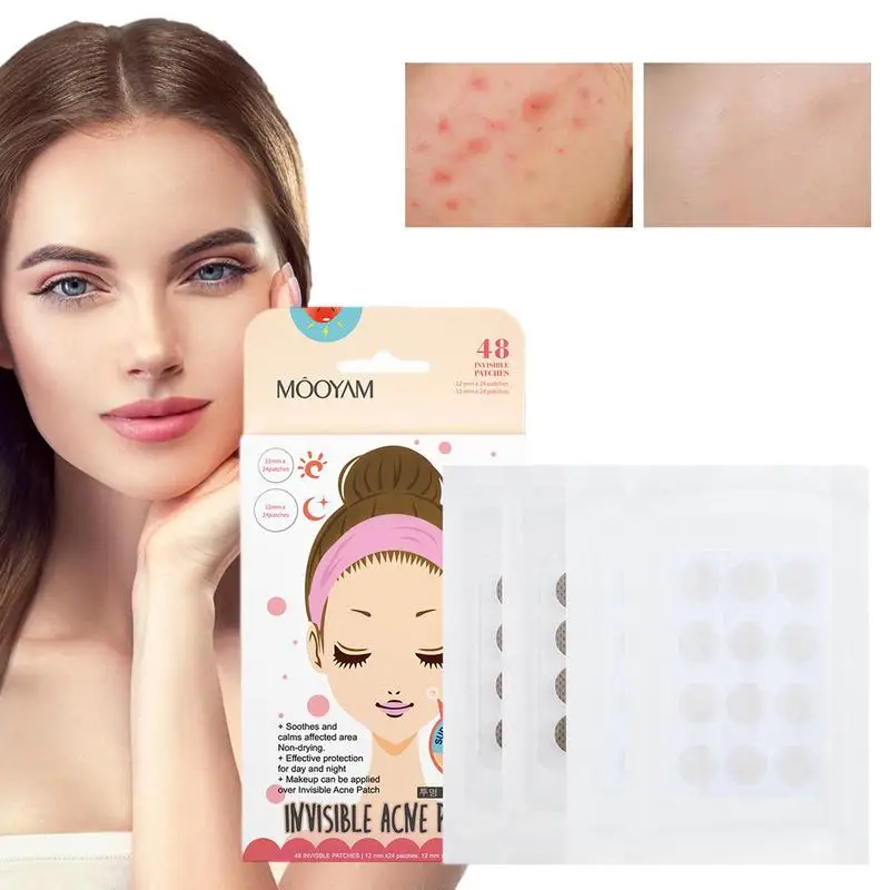 

Acnes Pimple Patch Sticker Acnes Treatments Pimple Remover Blemish Spot Facial Masque Skin Care Hydrocolloid Acnes Patch