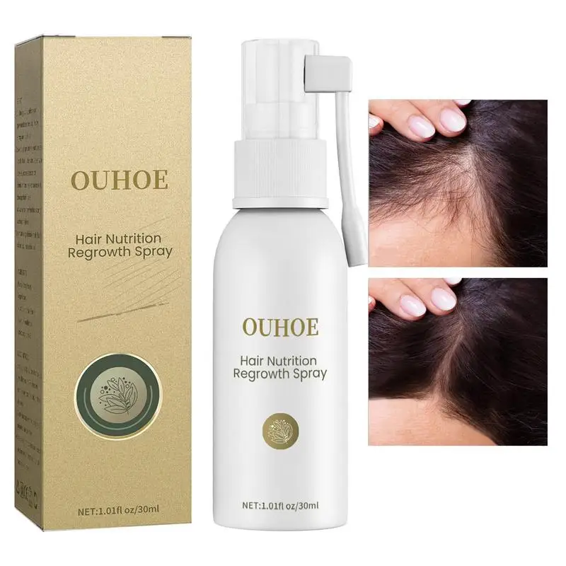 30ml Thinning Hair Growth Sprays Frizz Hair Volumizing Spray For Longer Thicker Fuller Hair Gifts For Men And