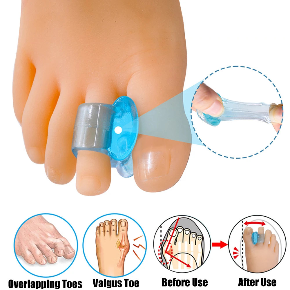 Bunion Silicone Toe Separator Corrector for Feet Women Men Hallux Valgus Bone Correction Foot Thumb Straightener Adjustable