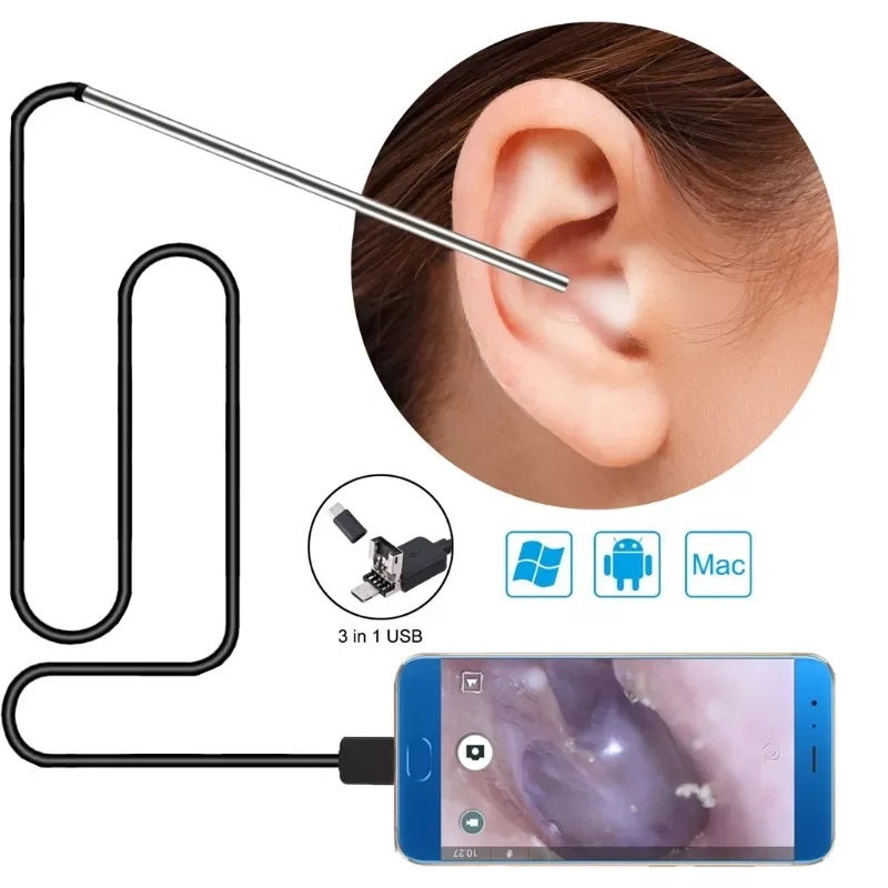 

3 в 1 инструмент для удаления ушного воска, USB-отоскоп-камера для ушной чистки эндоскоп, визуальная ухочистка 5,5 мм, отоскоп для ушей