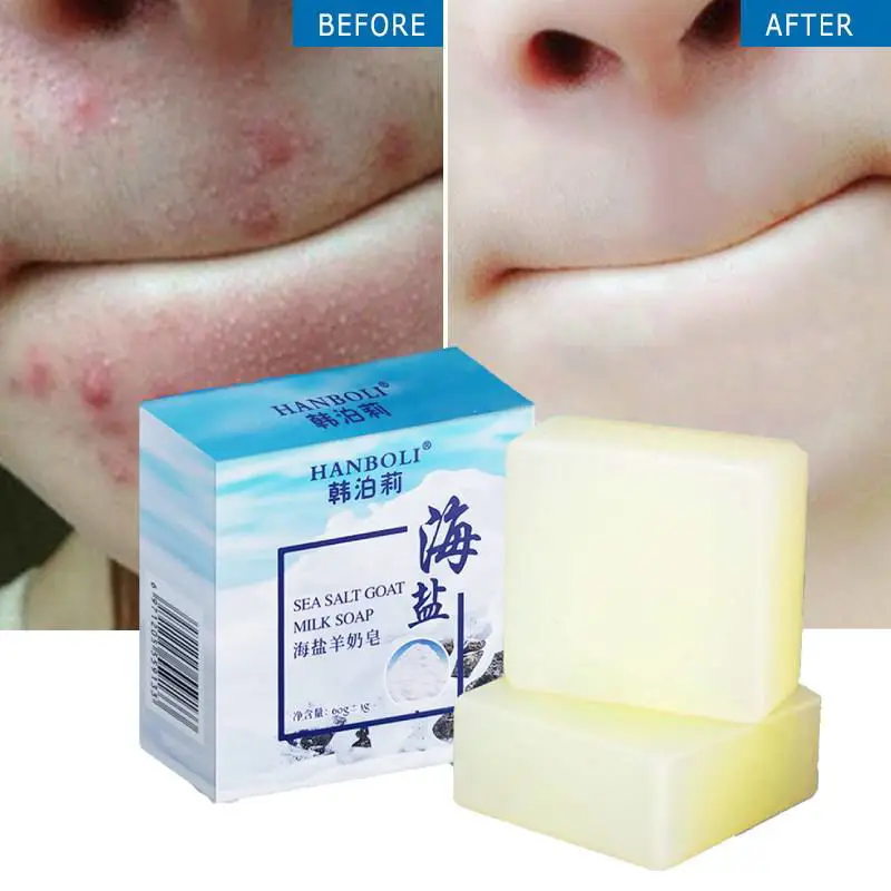 Sea Salt Soap Remover Pimple Pore Makeup Moisturize Face Wash Goat Milk Deep Cleansing Pores Blackheads Soft Skin | Красота и