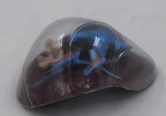 Прозрачная модель печени медицинская наука гепатический сегмент анатомический