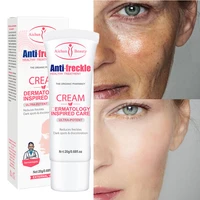 effective whitening freckle cream remove dark spots melanin melasma pigmentation skin tone whiten correcter brighten care