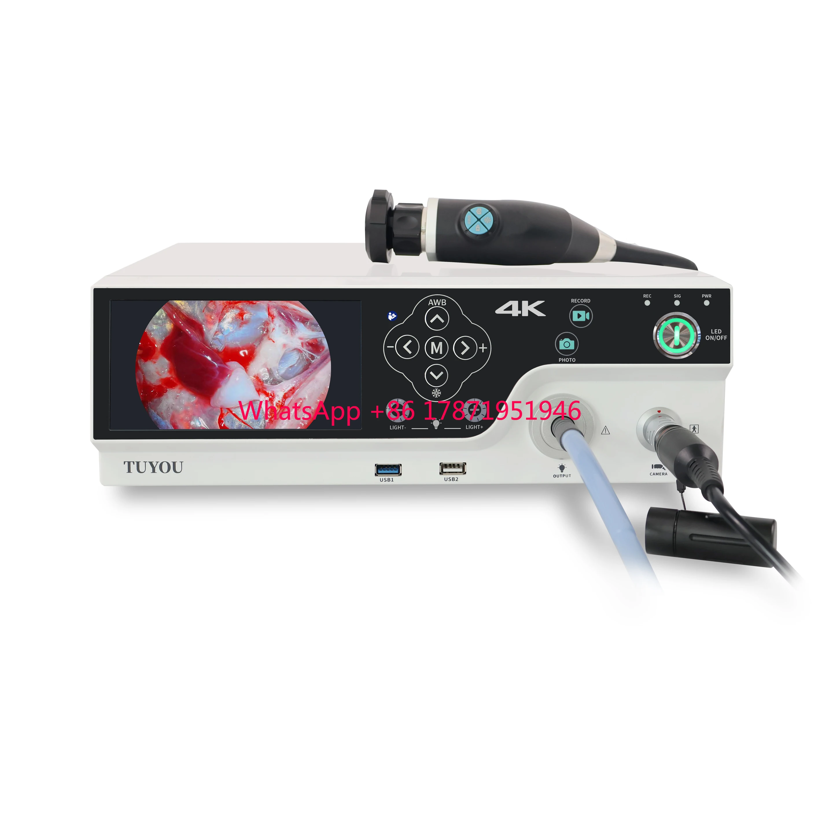 Медицинская эндоскопическая камера 4K с источником холодного света для