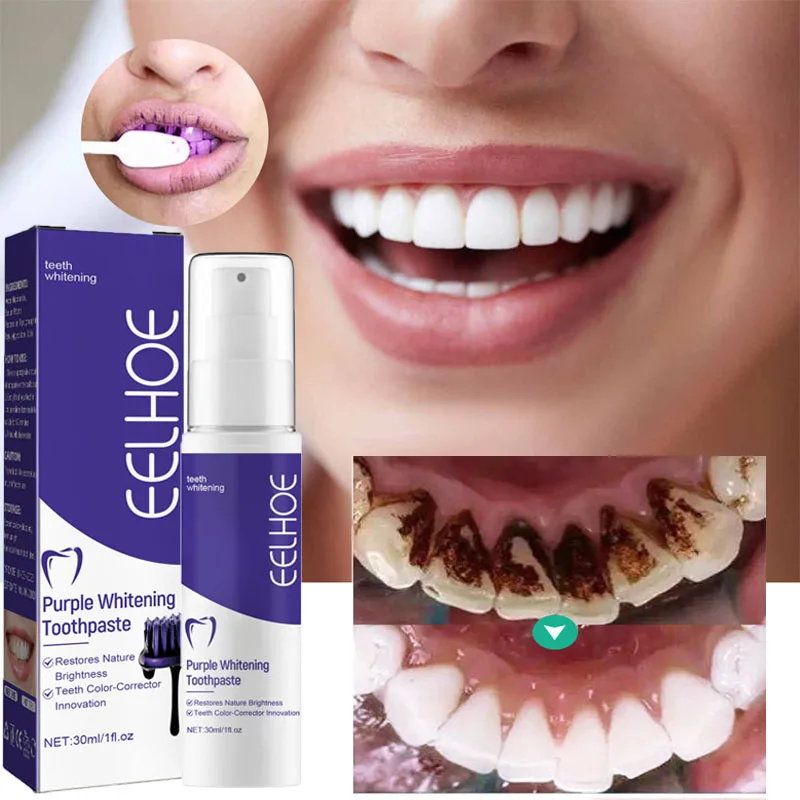 Teeth Whitening Toothpaste Remove Plaque Stains Oral Hygiene Bleaching Products Cleansing Fresh Breath Dentistry Care Tools 30ml