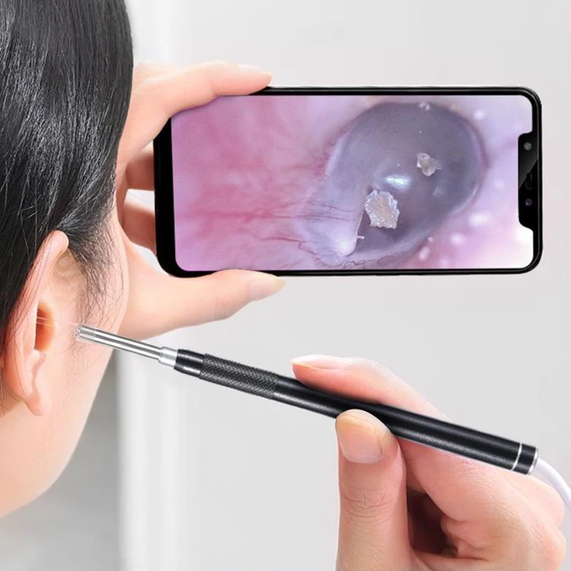 

Ear Stick Endoscope Earpick Camera Otoscope Ear Cleaner Ear Wax Remover Smart Visual Ear Cleaner Ear Picker Earwax Removal Tool