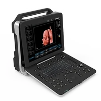 portable pregnancy test 3d4d5d color doppler medical ultrasound instruments ultrasonic machine