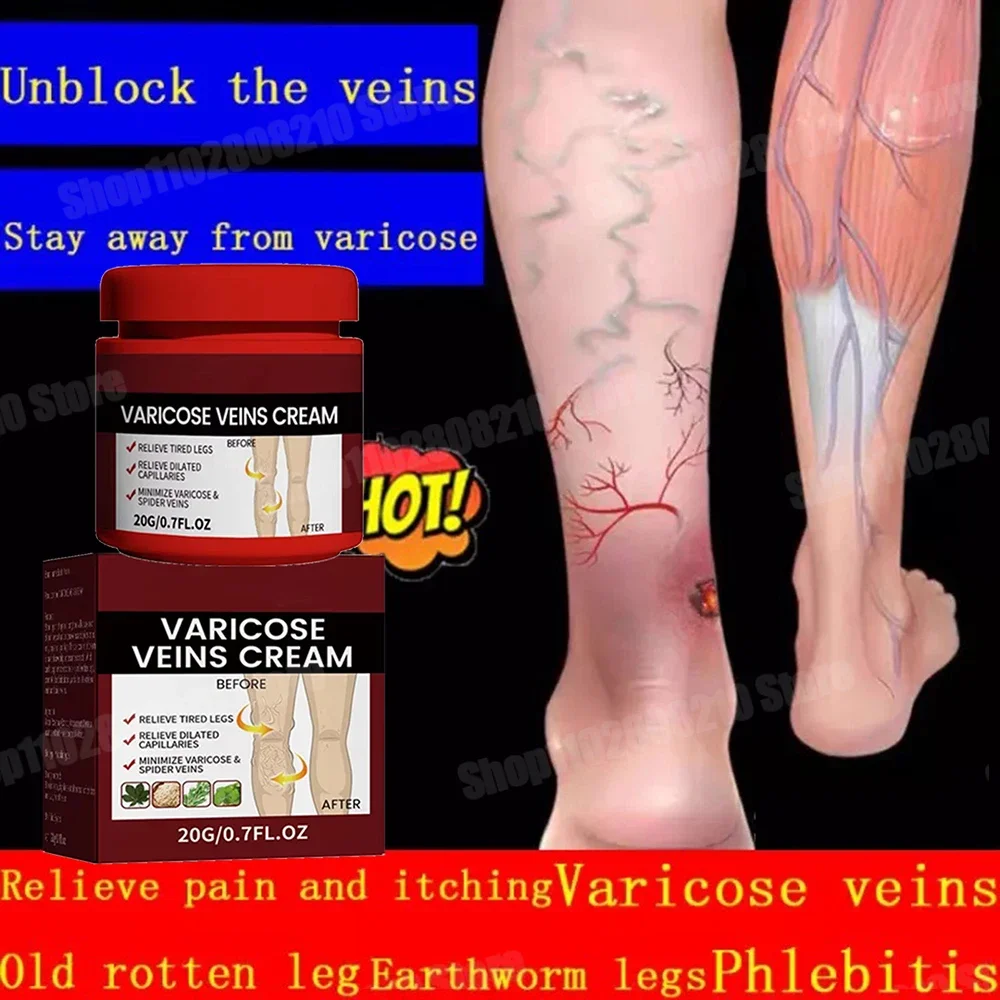 Антибактериальный крем от псориаза опояскивающий пенис экзема герпес