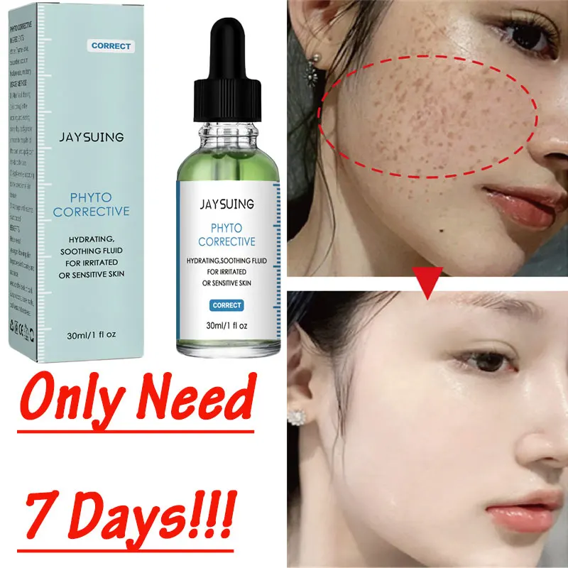 Freckle Remove Essence Fade Face Dark Spots Whitening Serum Reduce Chloasma Moisturize Nourish Brighten Whiten Skin Care Product