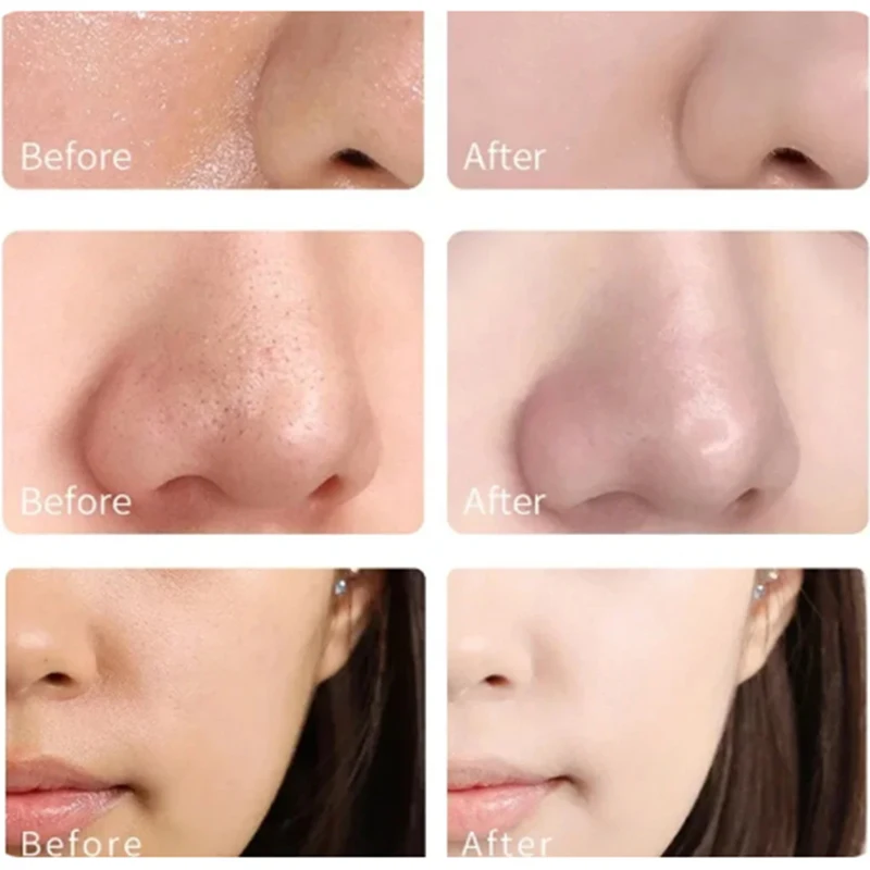 Маска для лица с зеленым чаем глубоко увлажняющая сужающая поры черные точки