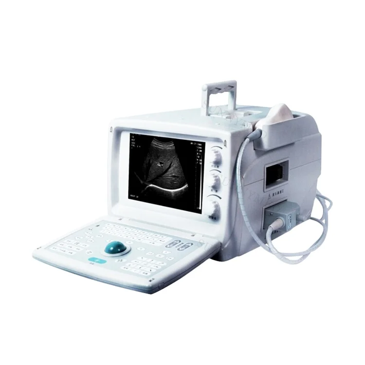 

SY-A001 Guangzhou Sunnymed medical B ultrasound scanner price