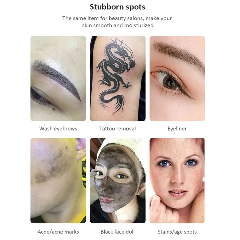 Портативный лазер для удаления татуировок 1604 нм 532 1320 Nd Yag лазерная машина Pico