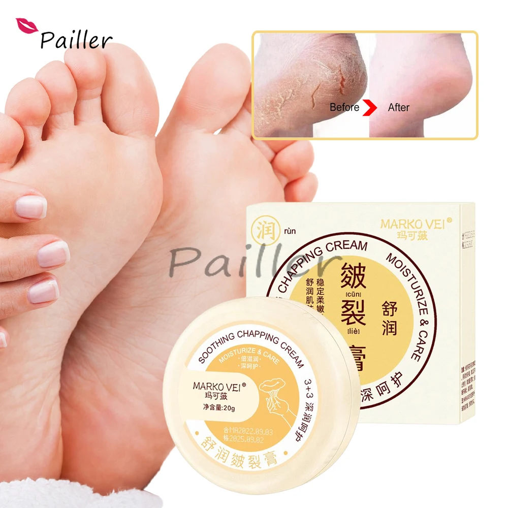 Relief For Extremely Dry Cracked Feet Instantly Boosts Moisture Levels Foot Care Whiten Natural
