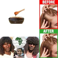 postpartum hair loss treatment using south african tribal herbal shampoo stop hair fall keratin supplement naturally regrow hair