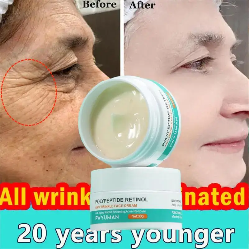 

Retinol Wrinkle Remover Face Cream Anti-Aging Lifting Firming Fade Fine Lines Acne Treatment Whitening Moisturizing Skin Care