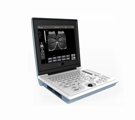 

Full Digital LED Professional laptop type black white ultrasound scanner with good price