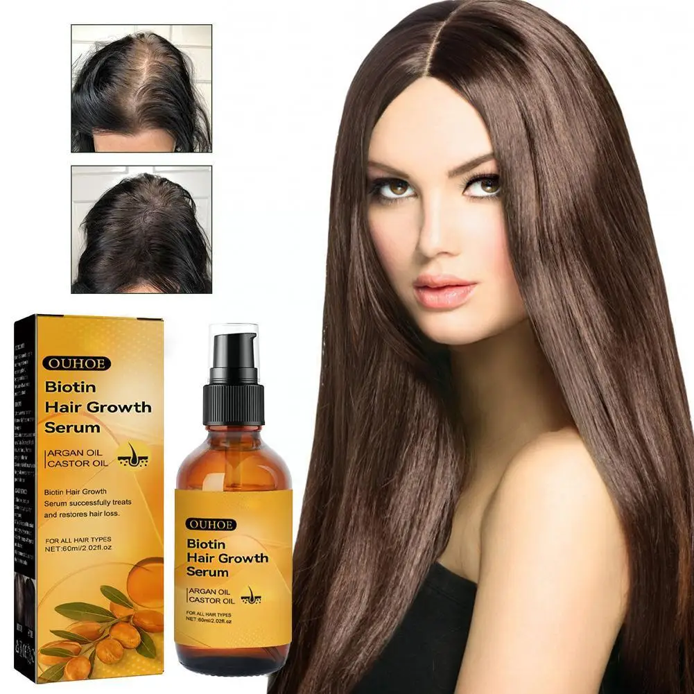 

60ml Essence Oil Biotin Hair Loss Oil Repair Serums Dry Damaged Hair Care Oil For Women Men Hair Ca Z1Q6