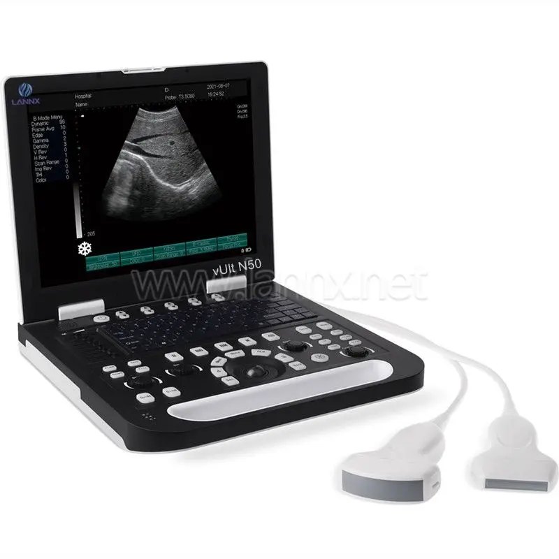 

LANNX vUlt N50 digital B ultrasound for veterinary medical Pet pregnancy ultrasound instruments Animal Portable USG test Machine