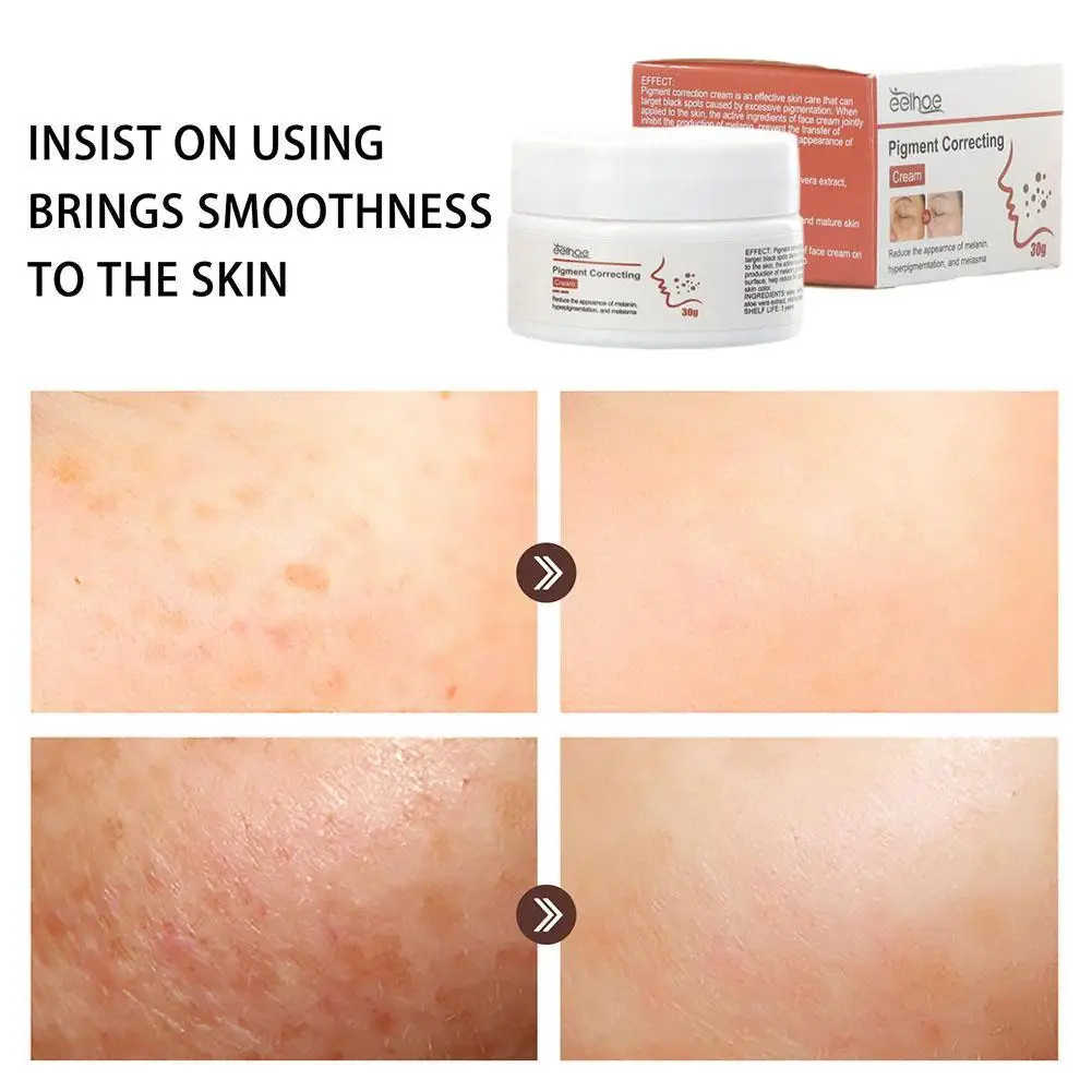 

EELHOE Pigment Correcting Cream Facial Brightening Facial Skin Face Care Spots Relief Cream 30g Sensitive Moisturizer Skin N2Z6