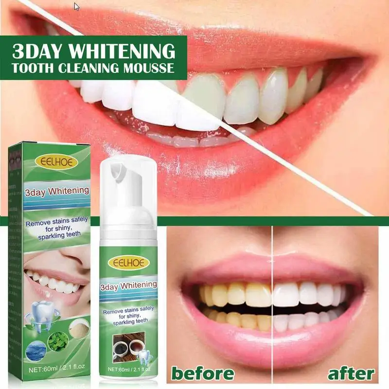 

Teeth Whitening Mousse Toothpaste Foam Cleansing Stains Yellow Teeth Remove Breath Freshen Whiten Tooth Toothpaste Care