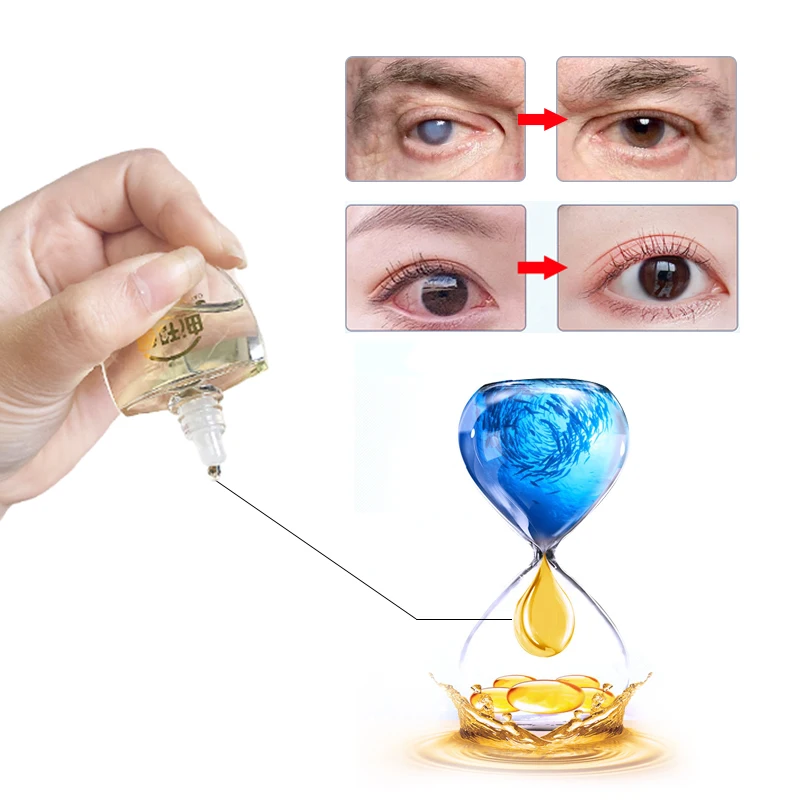 Cataract Treatment Medical Cod Liver Oil Eye Drops CFDA Approve For Black Overlapping Shadow Cloudy Eyeball Blurred Vision 12Ml |
