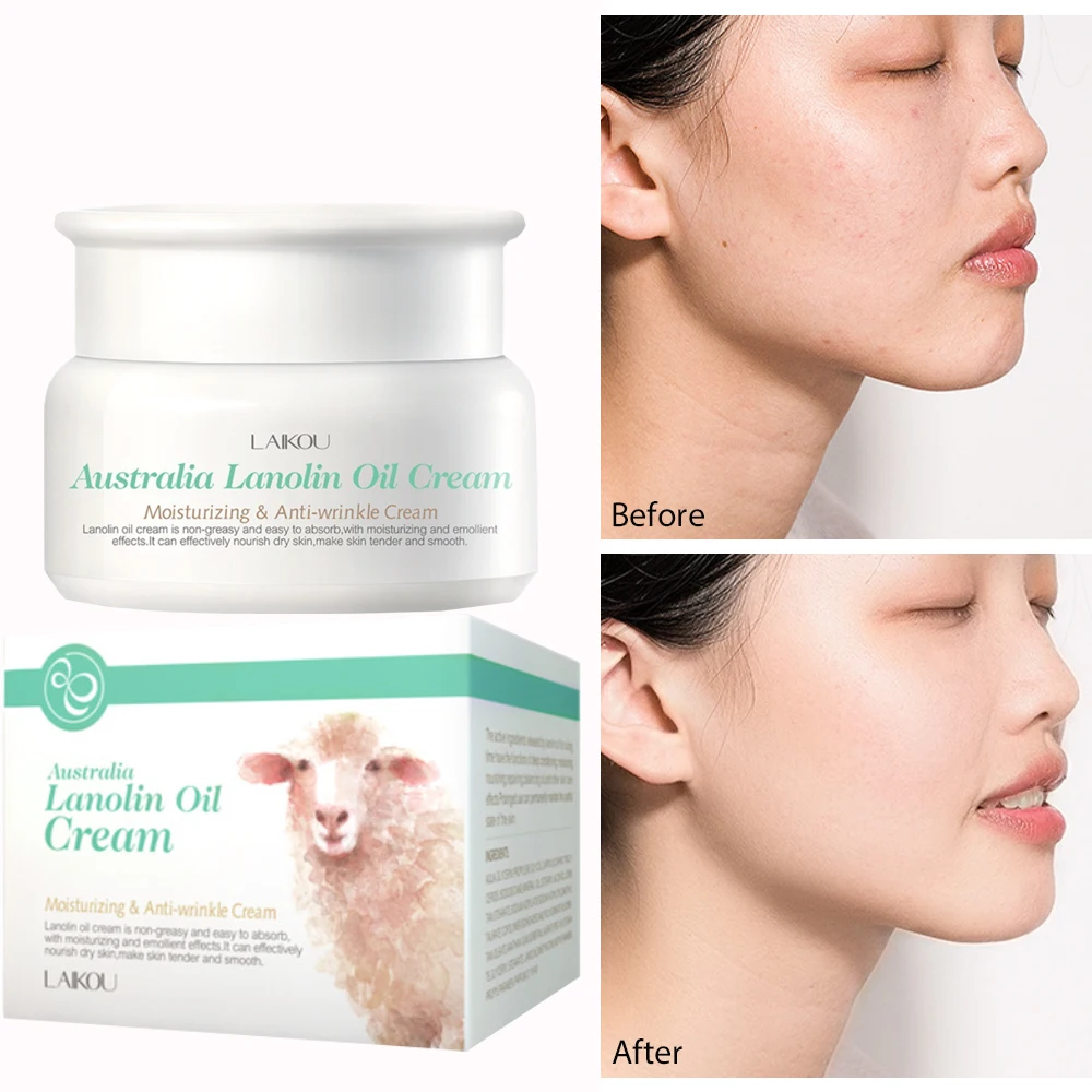 

Lanolin Oil Moisturizer Face Cream Lotion Creme Eclaircissante Visage Corporal Anti Tache Crema Hidratante Facial Blanqueadora